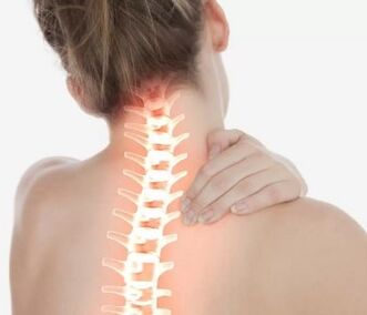 Cervicale osteochondrose